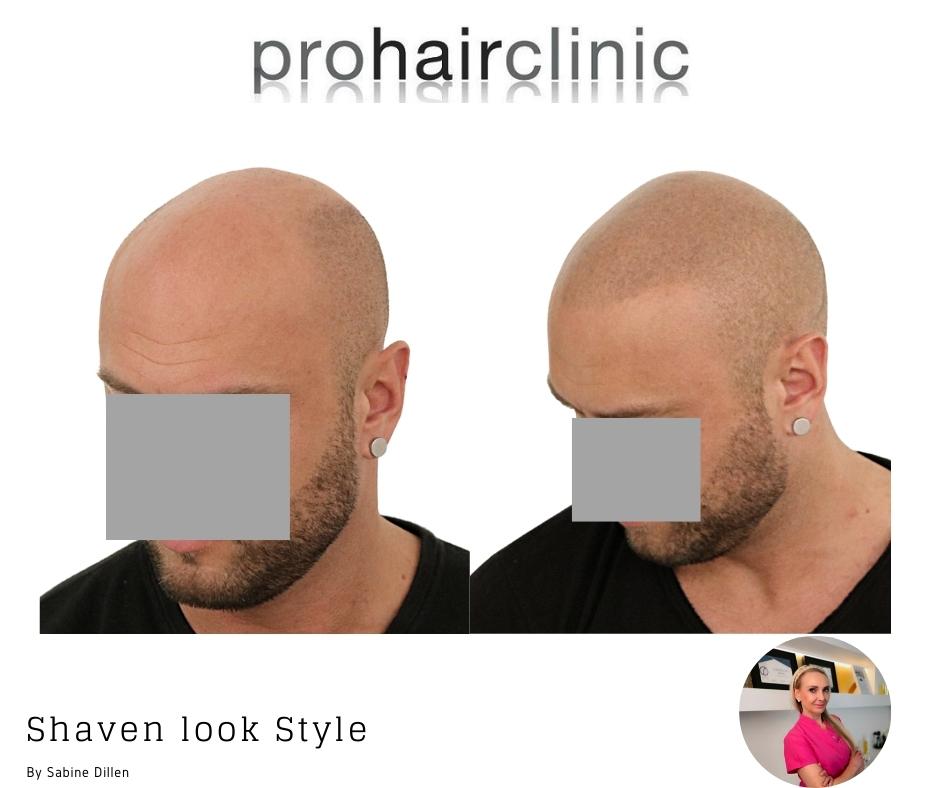 Hairstyle Options For A Receding Hairline | 18/8 Men's Salon Carmel